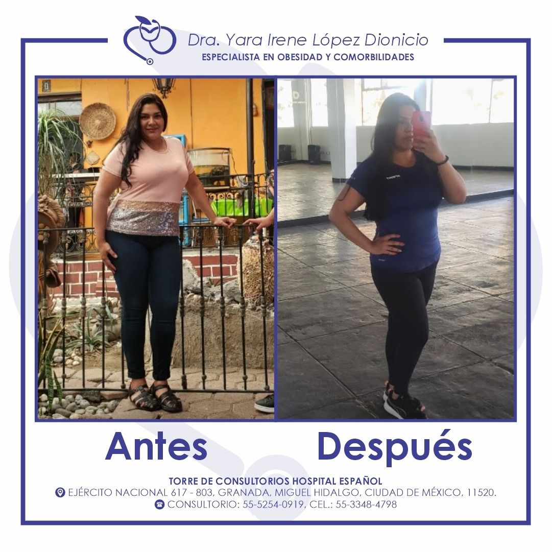 Yara Irene López Dionicio-3