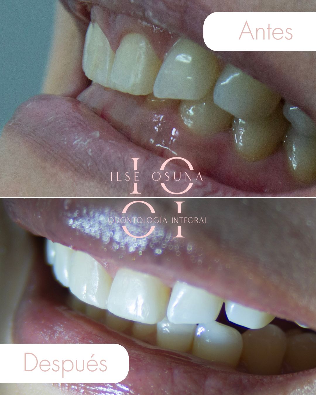 Ilse Valeria Osuna Rodríguez-10