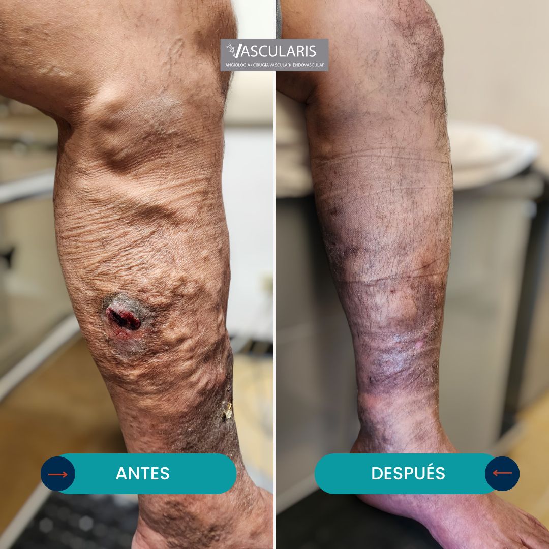 Jose Aristeo Reyes Monroy-0