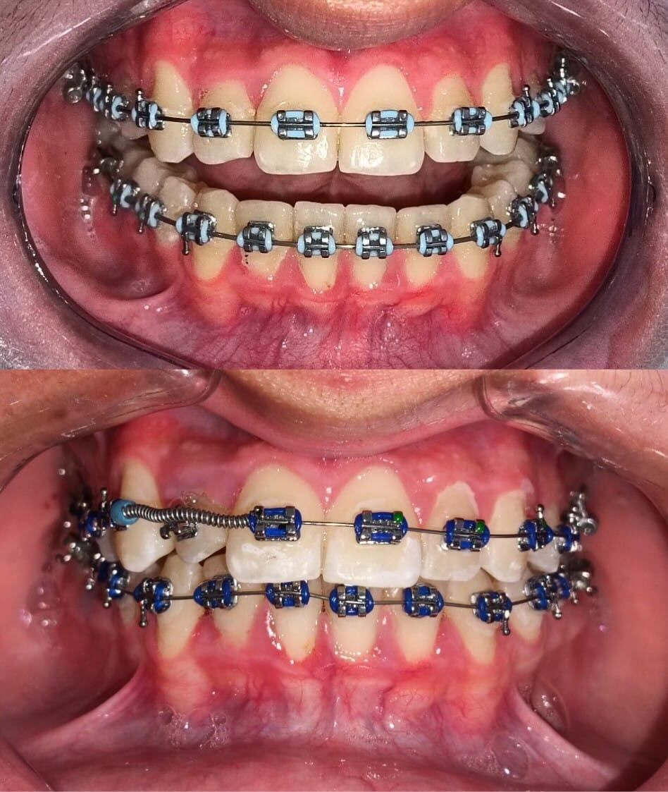 Luz Anel Valente Lozano-2