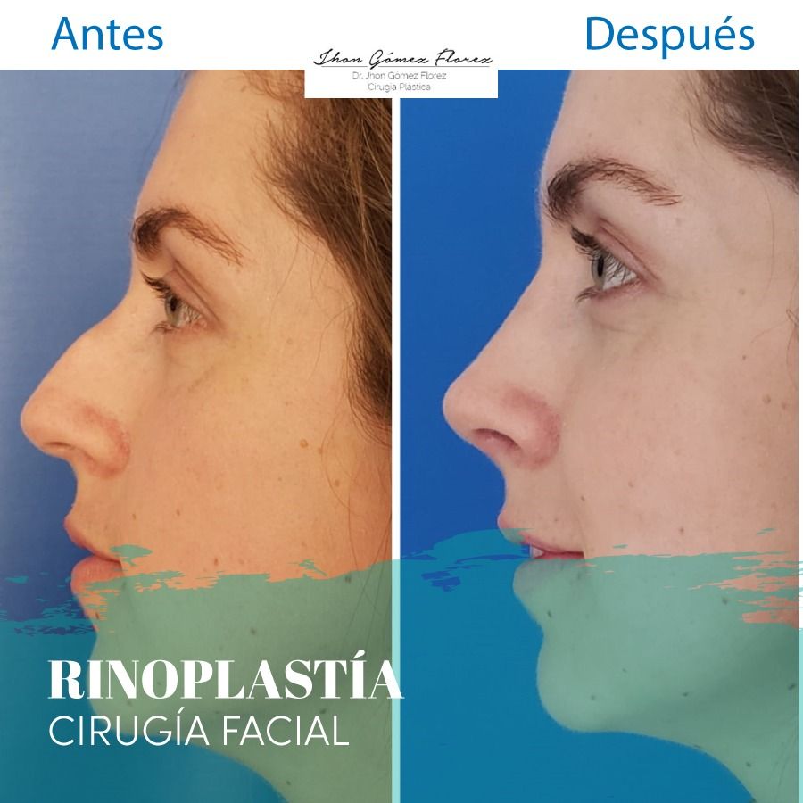 Jhon César Gómez Florez-65