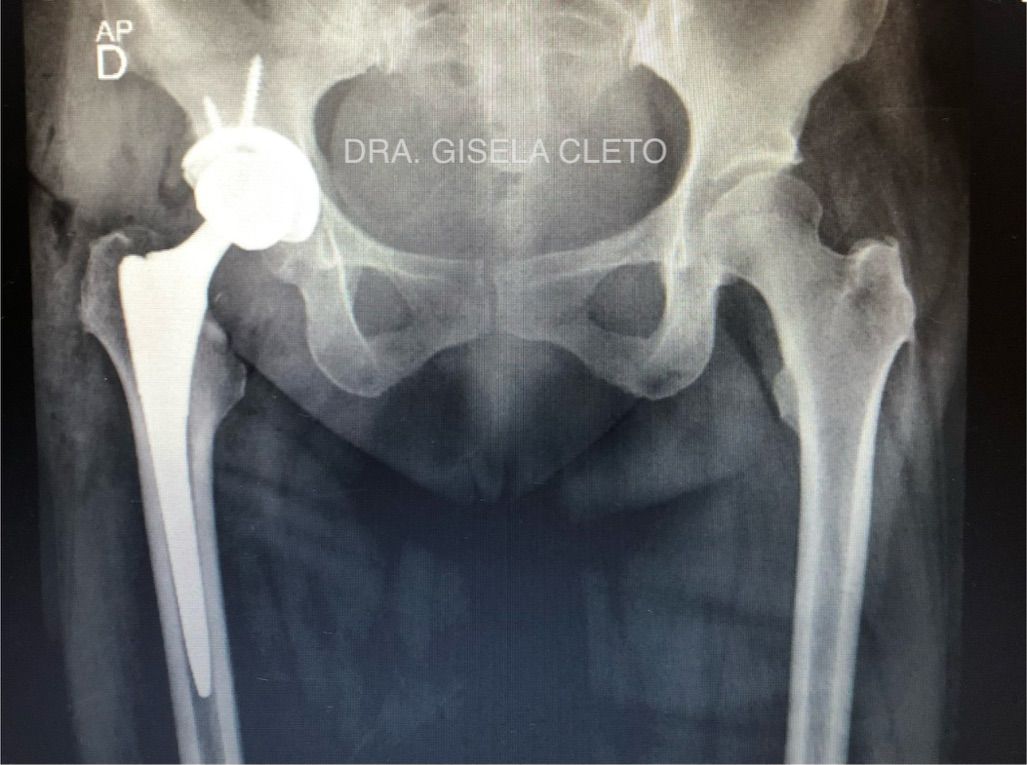 Gisela Cleto Zepeda-116