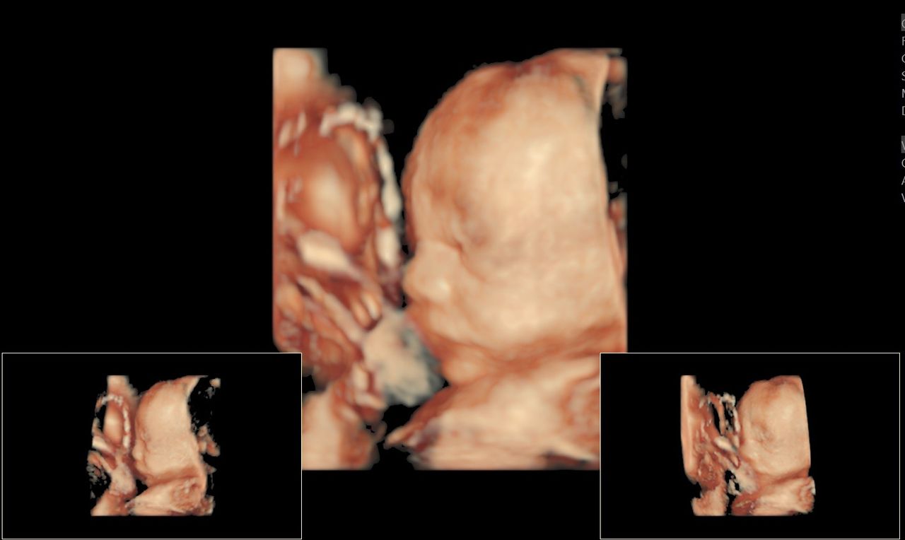 Jorge Luis Bautista Saldierna-6