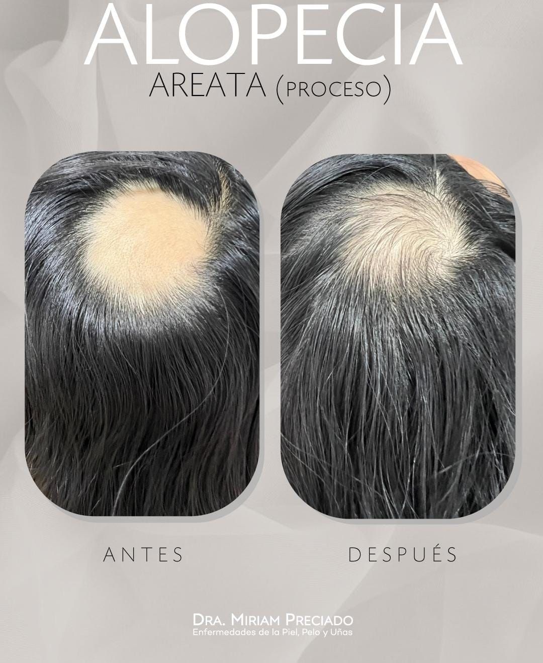 Miriam Sarahi Preciado Aguiar-2