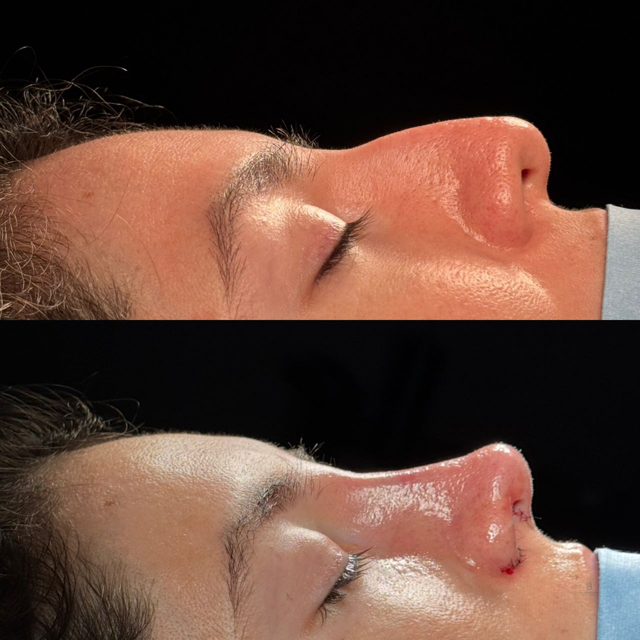 Angel Castro Urquizo-230