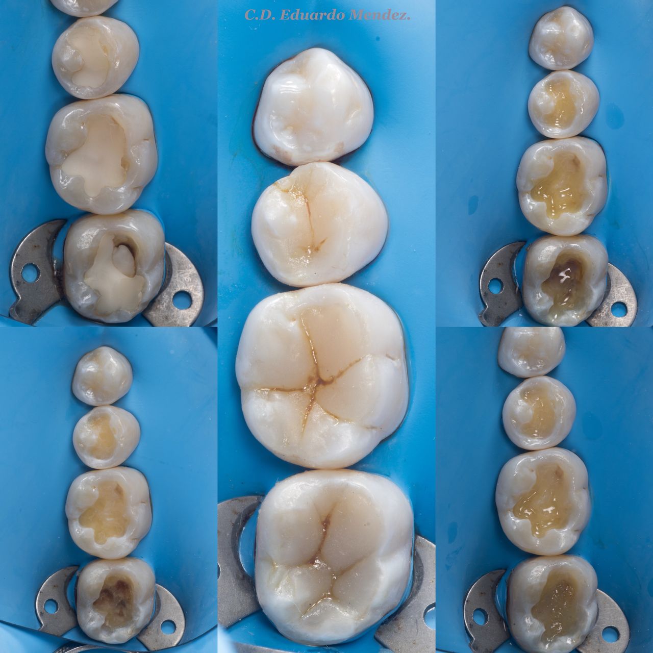 Hervin Eduardo Mendez Borrego-21