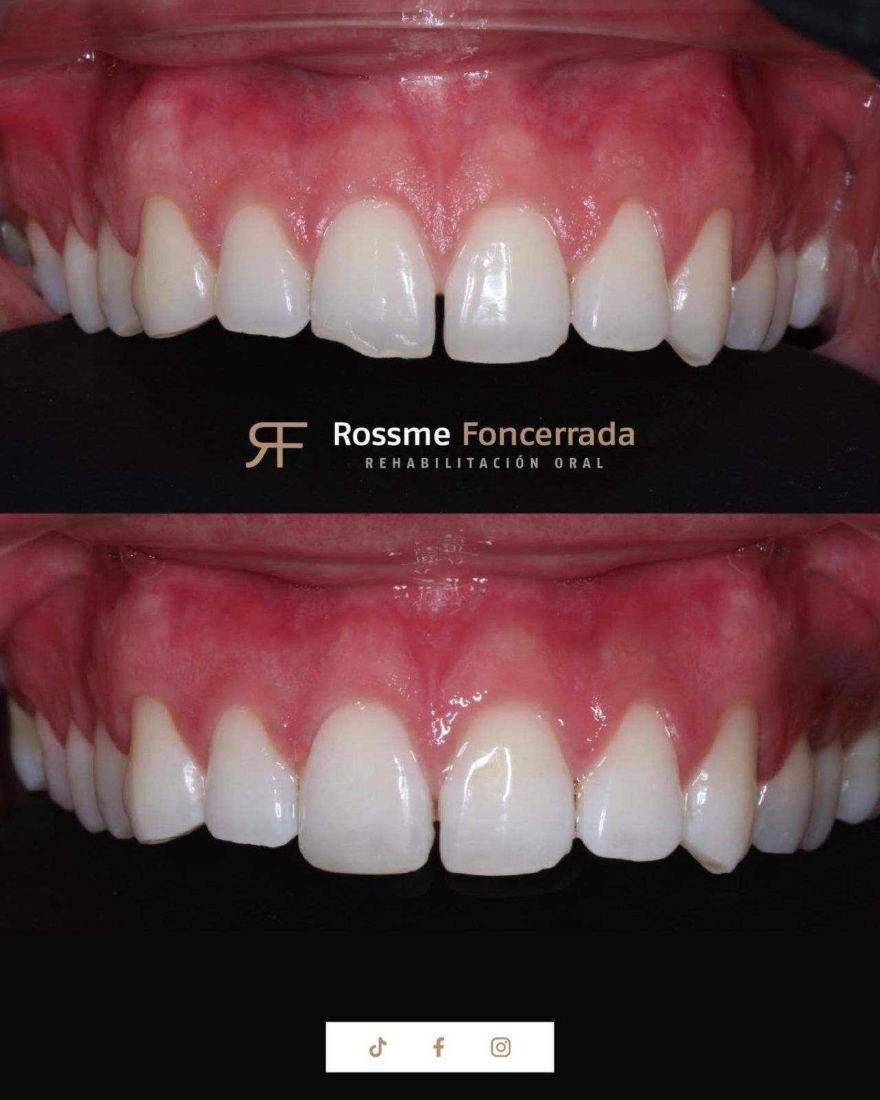 Rossme Foncerrada-18