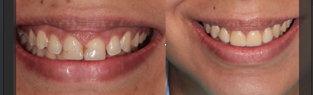 Andrea Cervantes Urenda-21