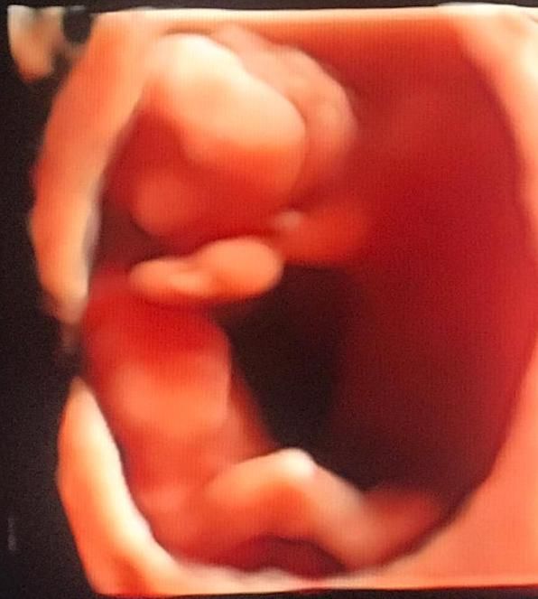 Germán Gabriel Palacios López-8