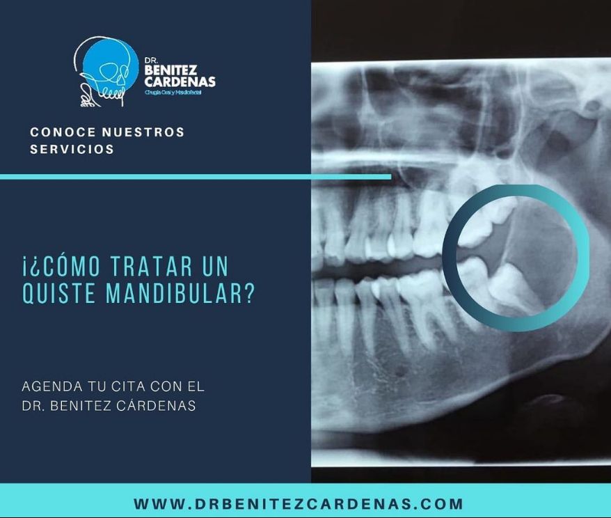 Oscar Arturo Benítez Cárdenas-9