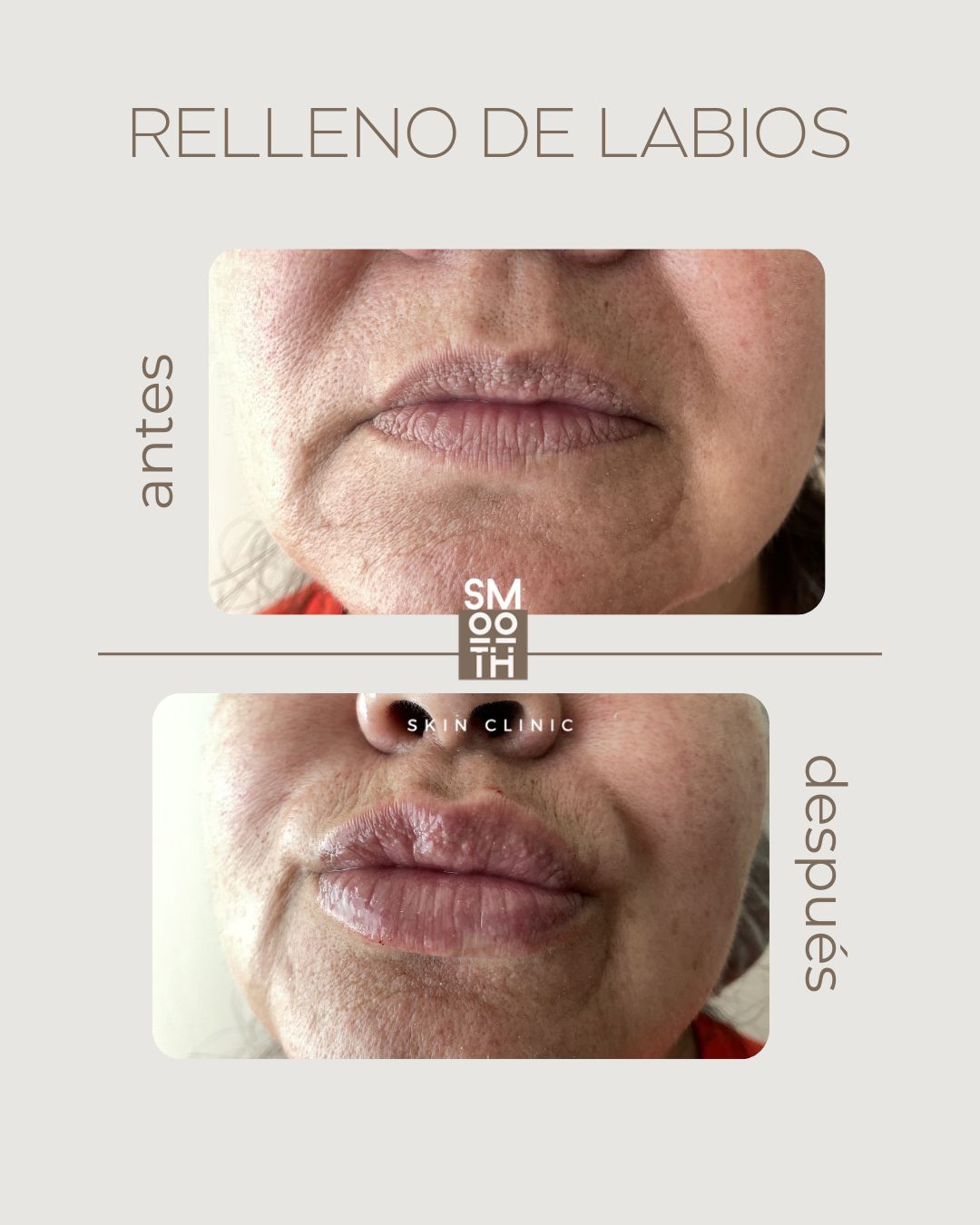 Samantha Martínez-79