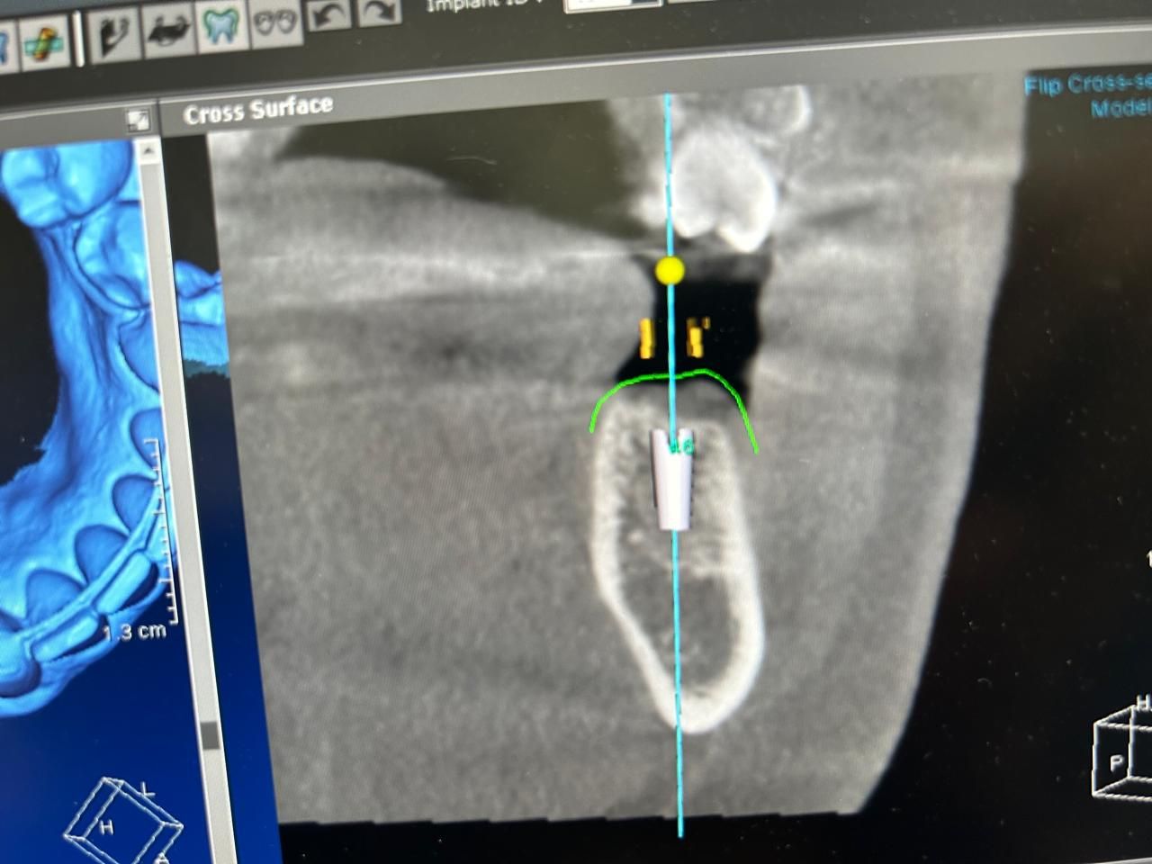 José Alberto Martínez Basulto-0