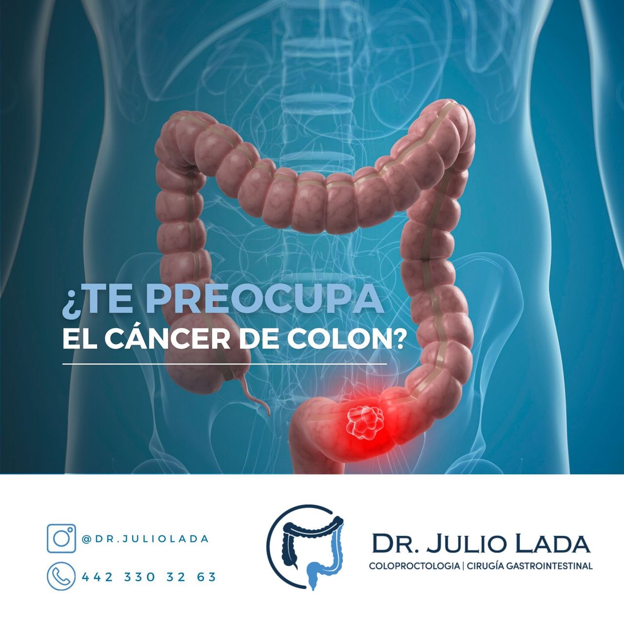 Julio Alberto Lada Xicum-2