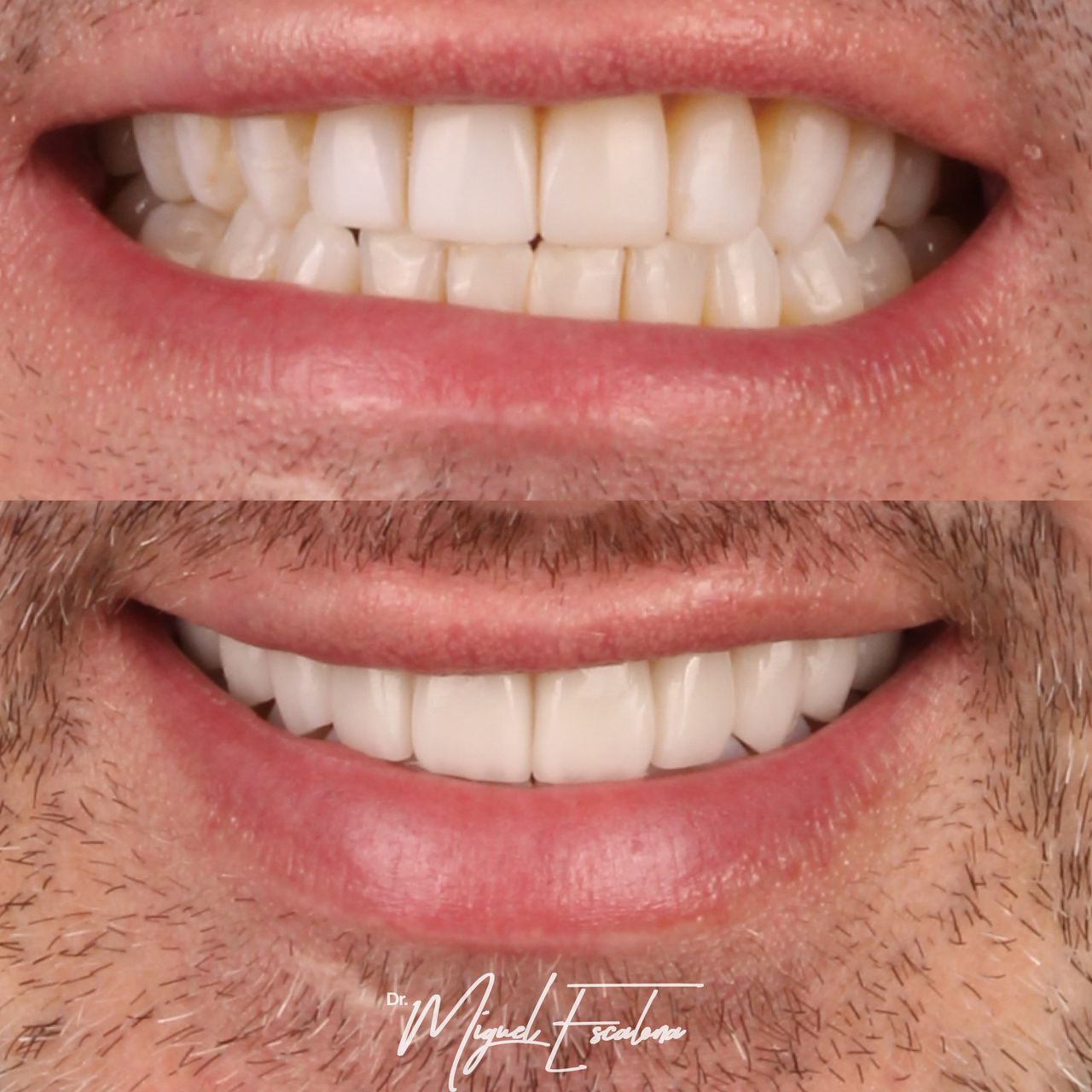 Miguel Alberto Escalona Mora-0