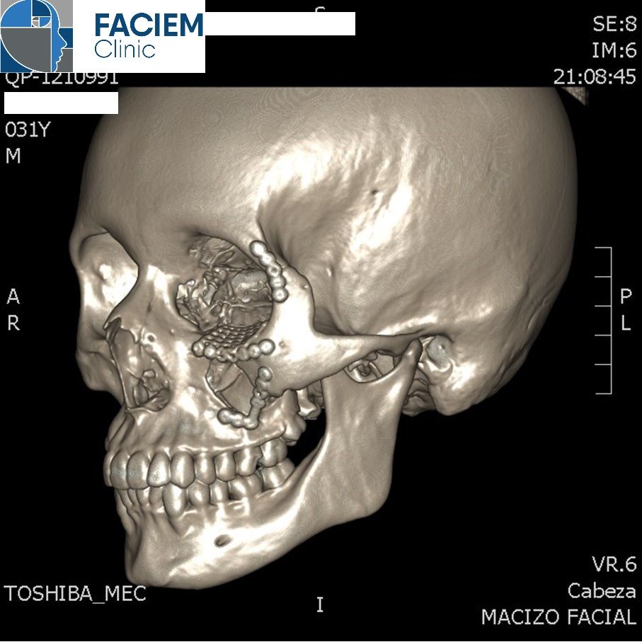Arlen Colín Ordaz-47