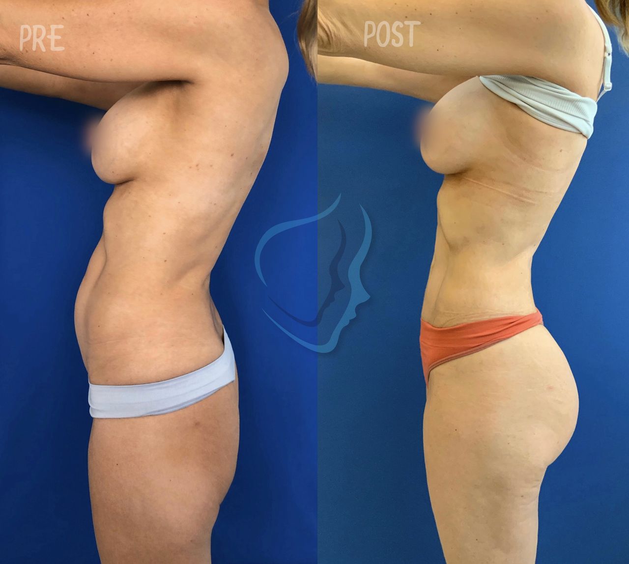 Giuseppe Tanzillo-43