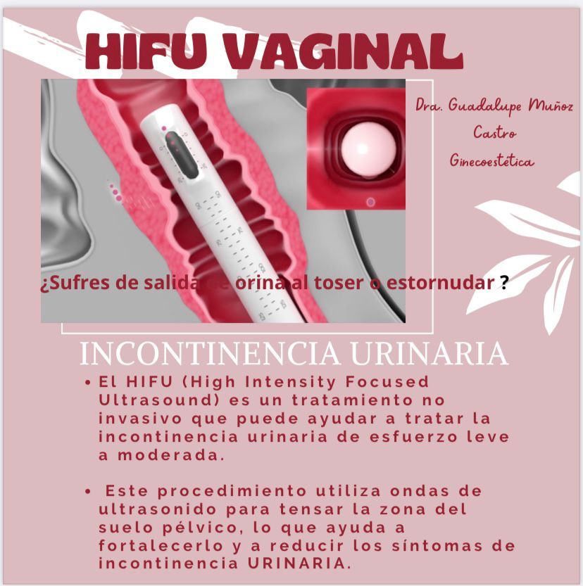 Guadalupe Muñoz Castro-117