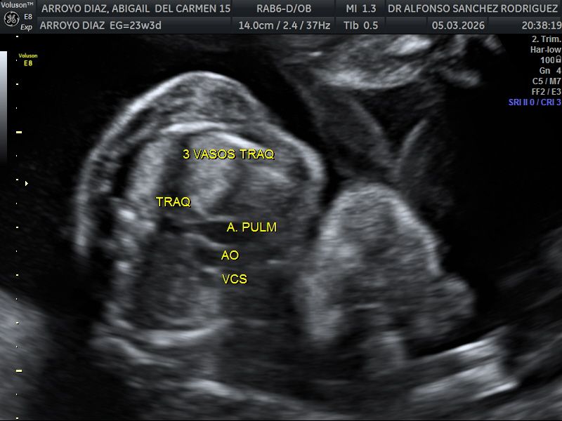 Alfonso Sanchez Rodriguez-71