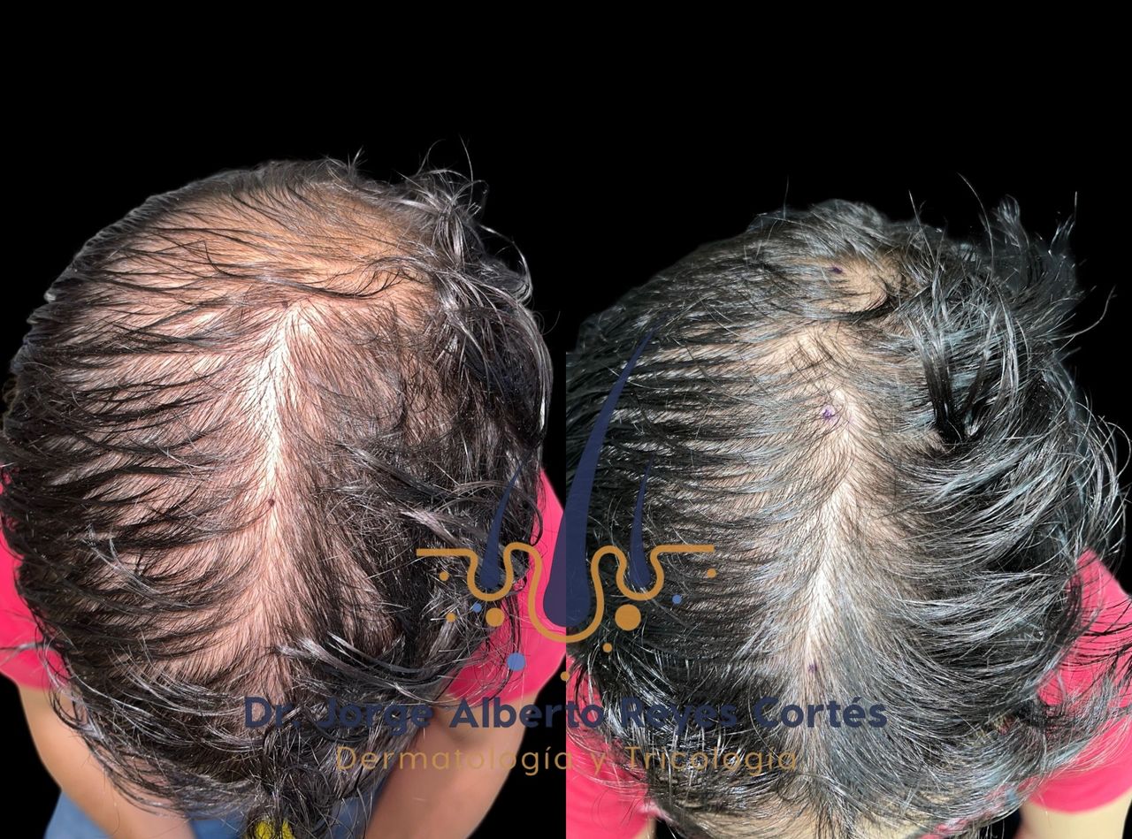 Jorge Alberto Reyes Cortés-3