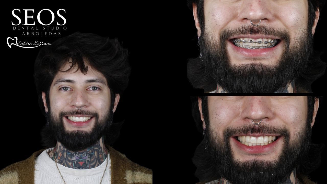 Edwin Serrano-19