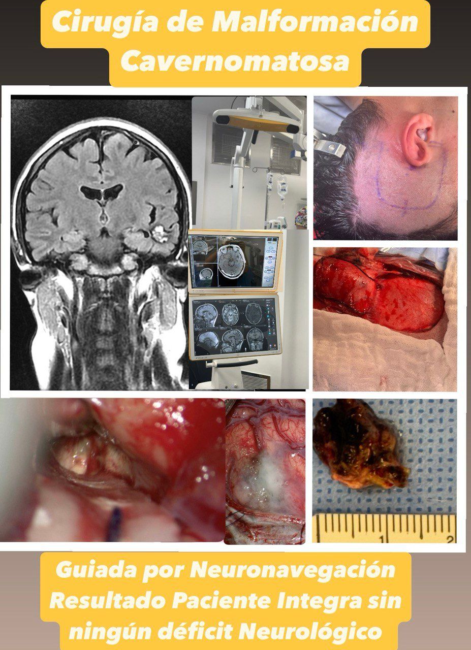 Alan Ferrufino Mejia-26