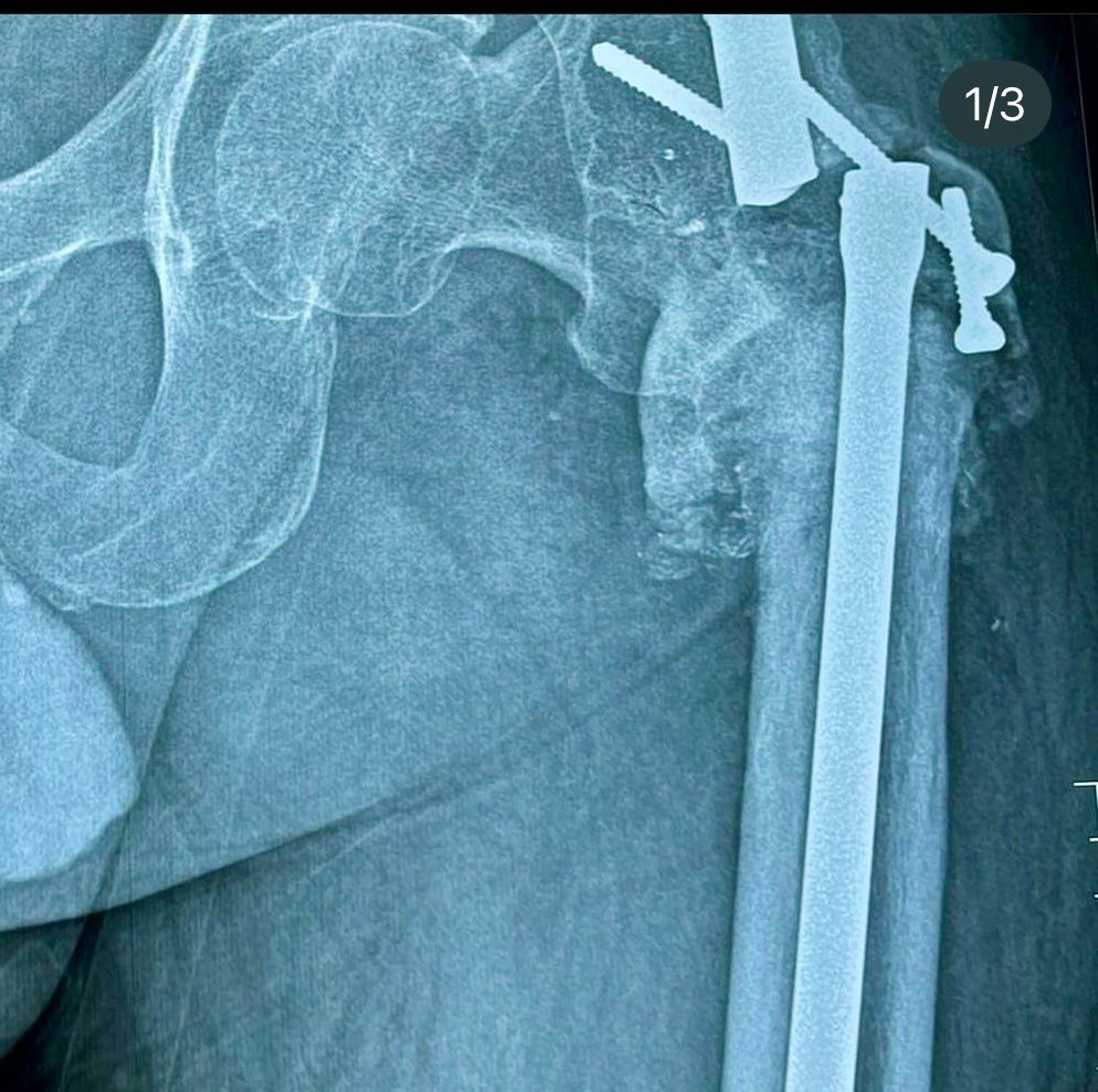 Irving Alejandro Mendoza Padilla-2