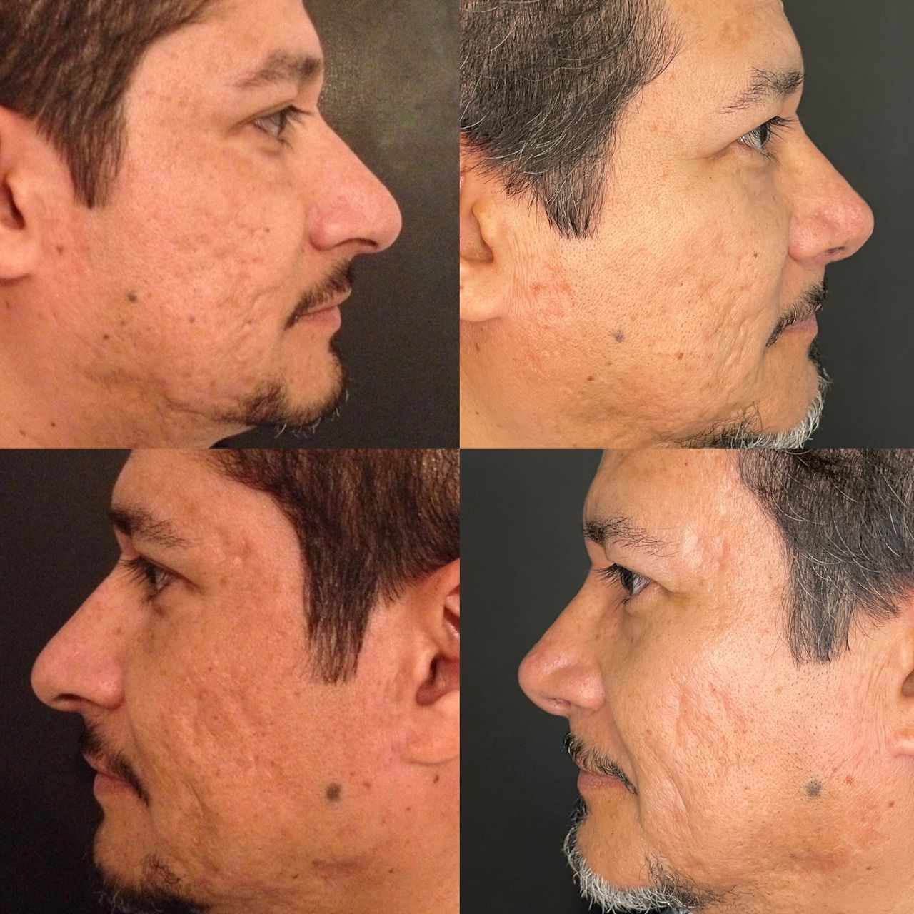 Teresita Flores Saldaña-2