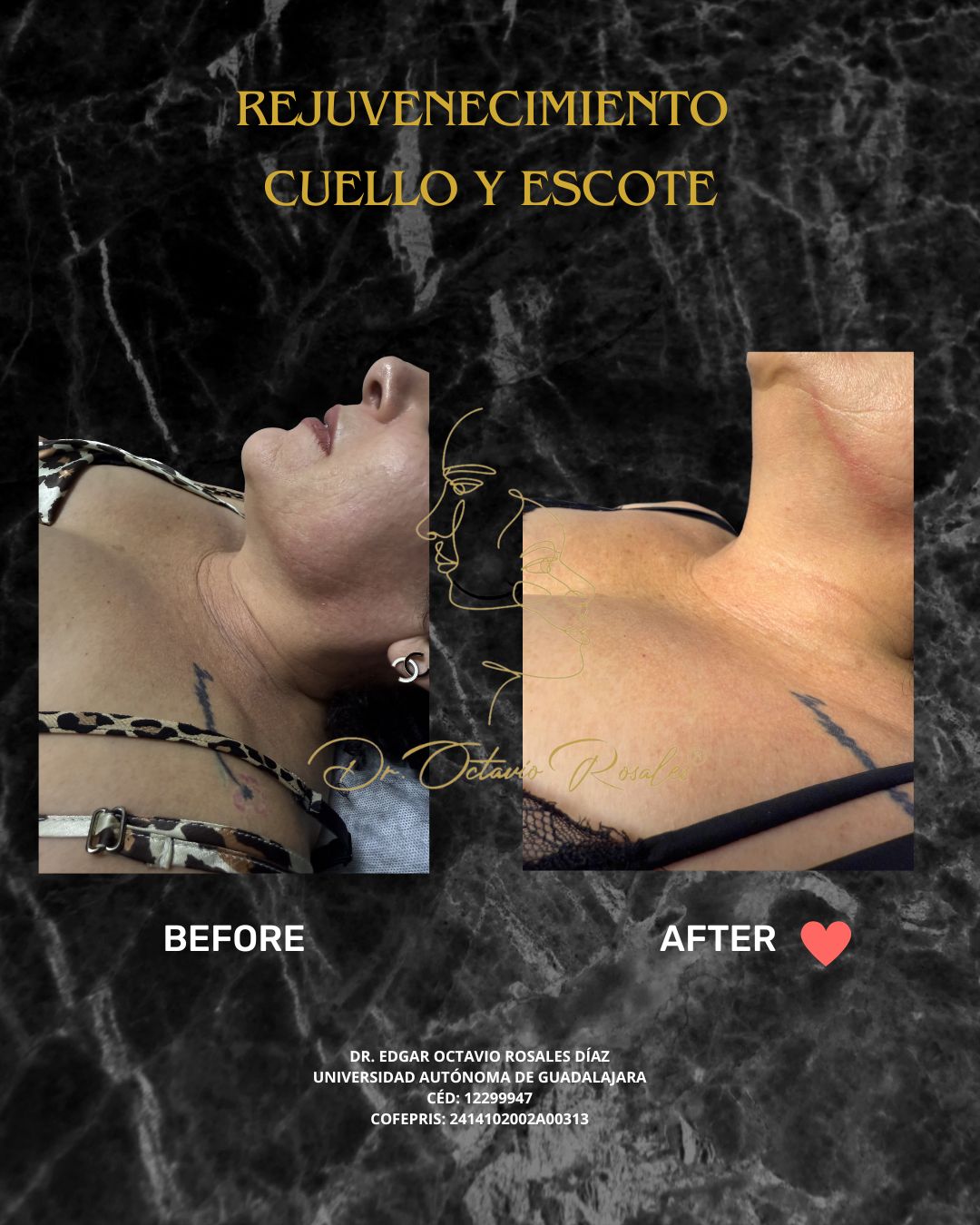 Edgar Octavio Rosales Diaz-25