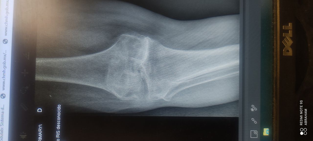 Abraham Israel Tachiquín Ruiz-5