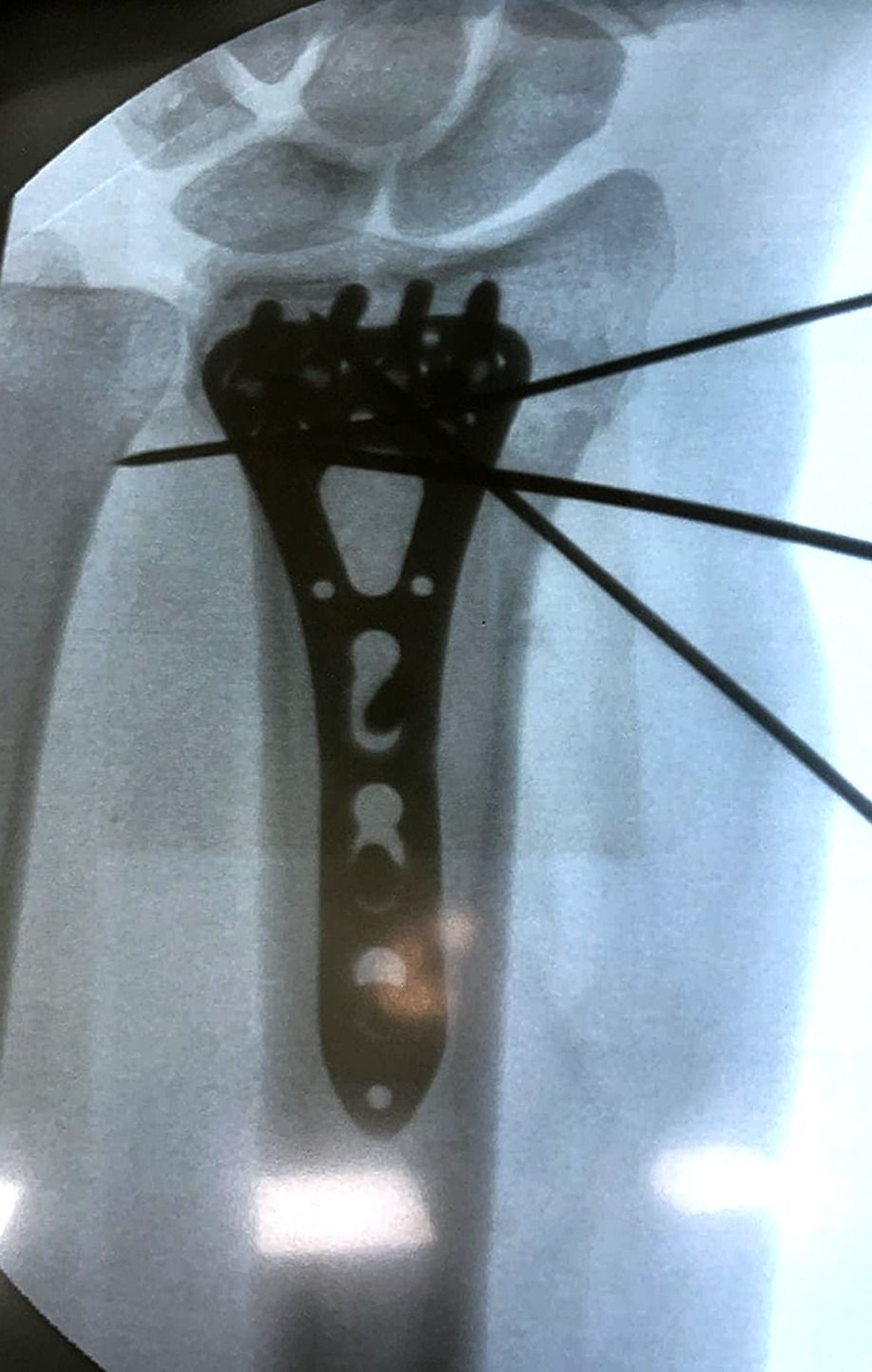 Rubén Rodriguez Acosta-1