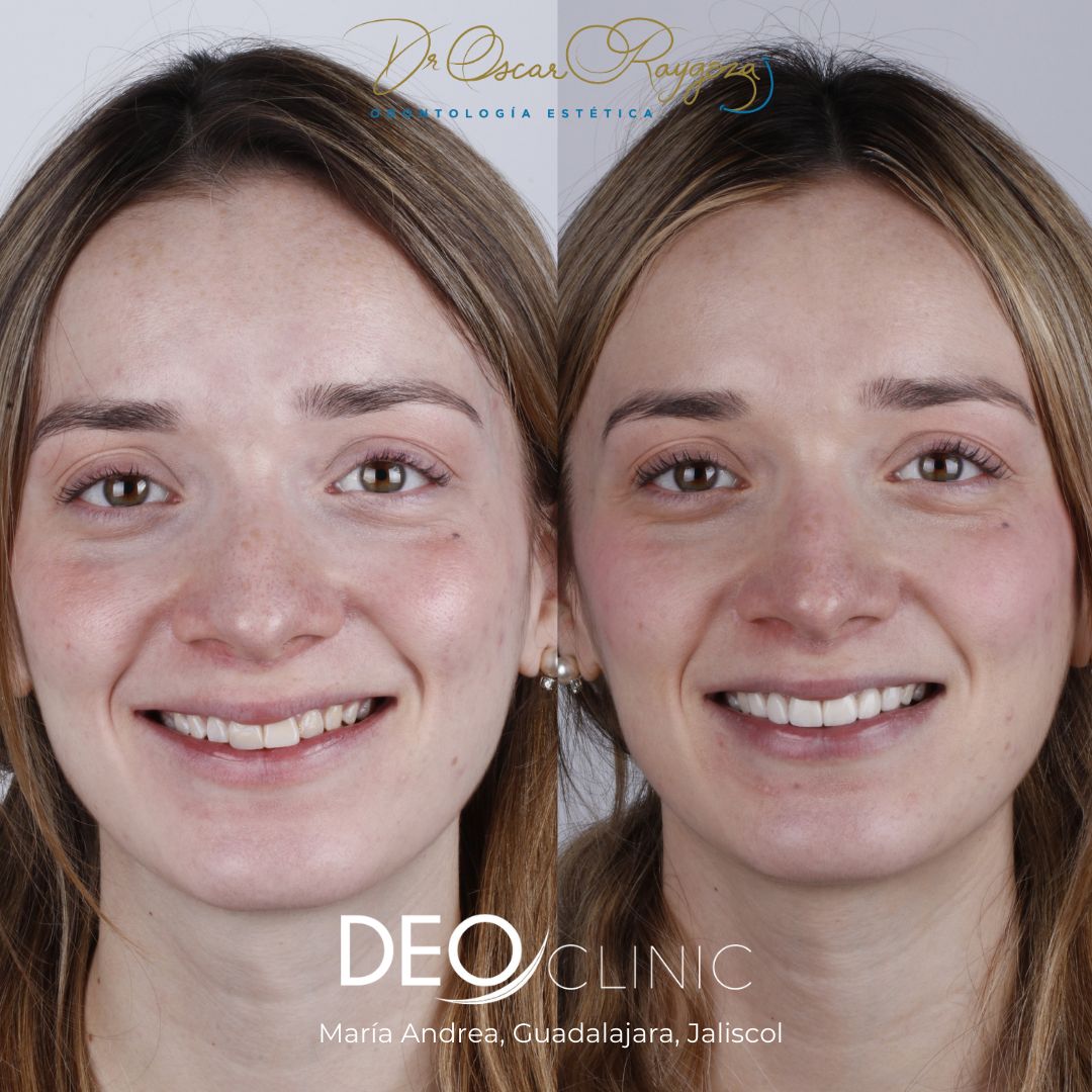 Oscar Raygoza Carrillo-18