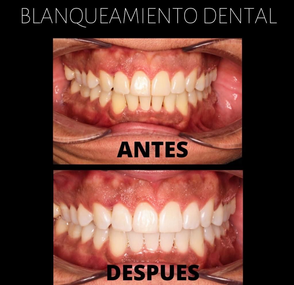 Lidia Abigail Hinojosa Arellanes-14