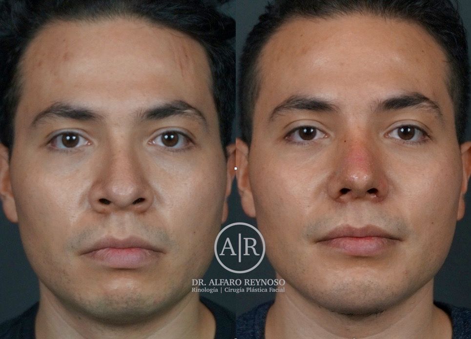 Jose Alberto Alfaro Reynoso-3