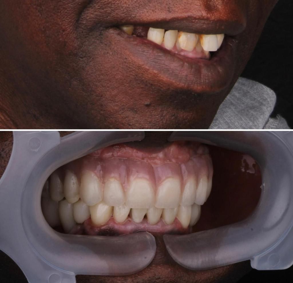 Josué Márquez Gómez-45