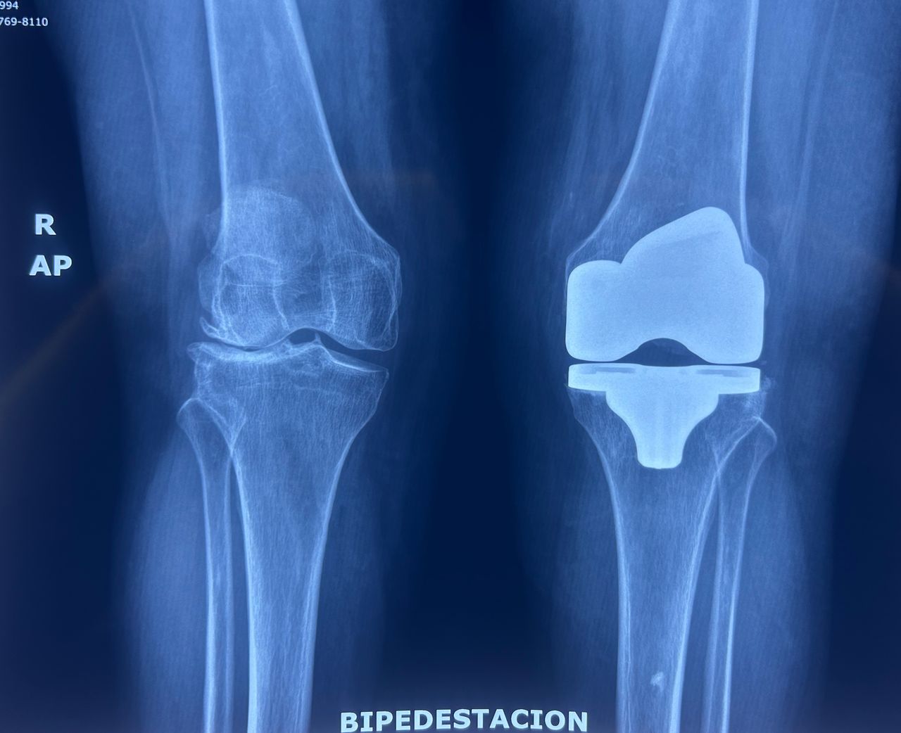 Giovanny Santander Becerra-41