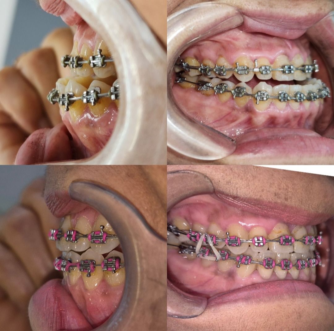 Kevin Matheus Flores Moraz-0