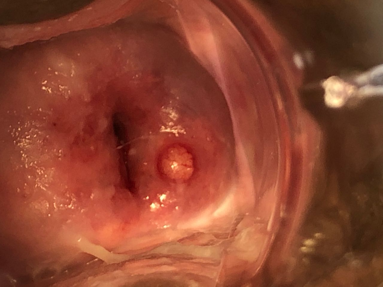 Lorena Balladares Macedo-11