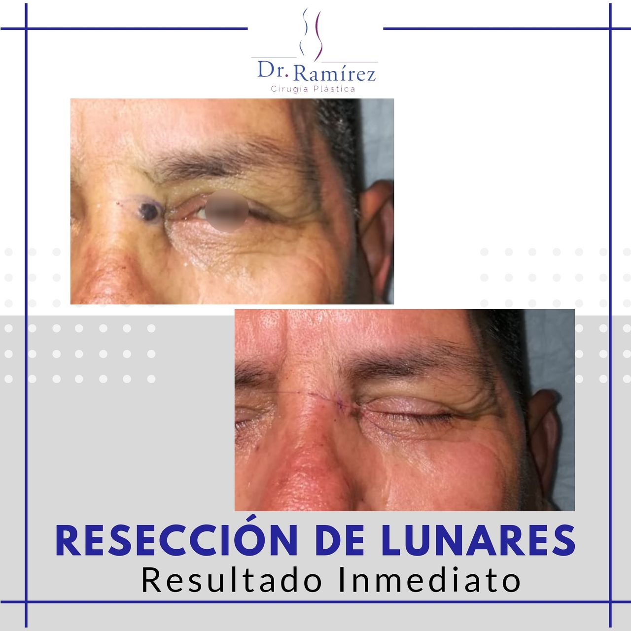 Edgar Ramírez López-106