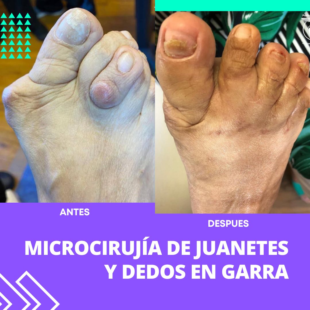 Carlos Alberto Haro Prieto-7