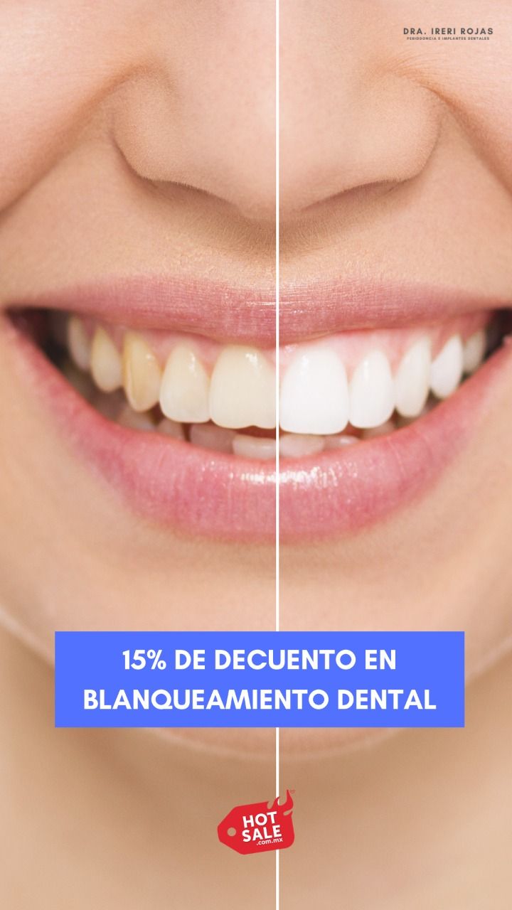 Ireri Rojas Bermúdez-3