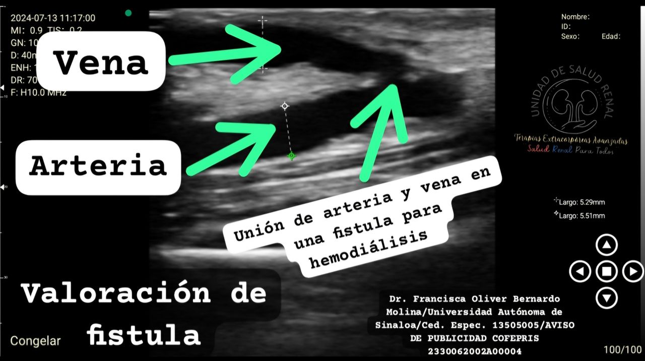 Francisco Oliver Bernardo Molina-1