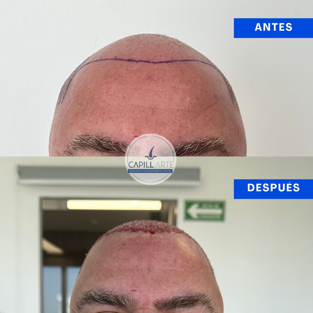 Adrian Hernandez Lopez-33