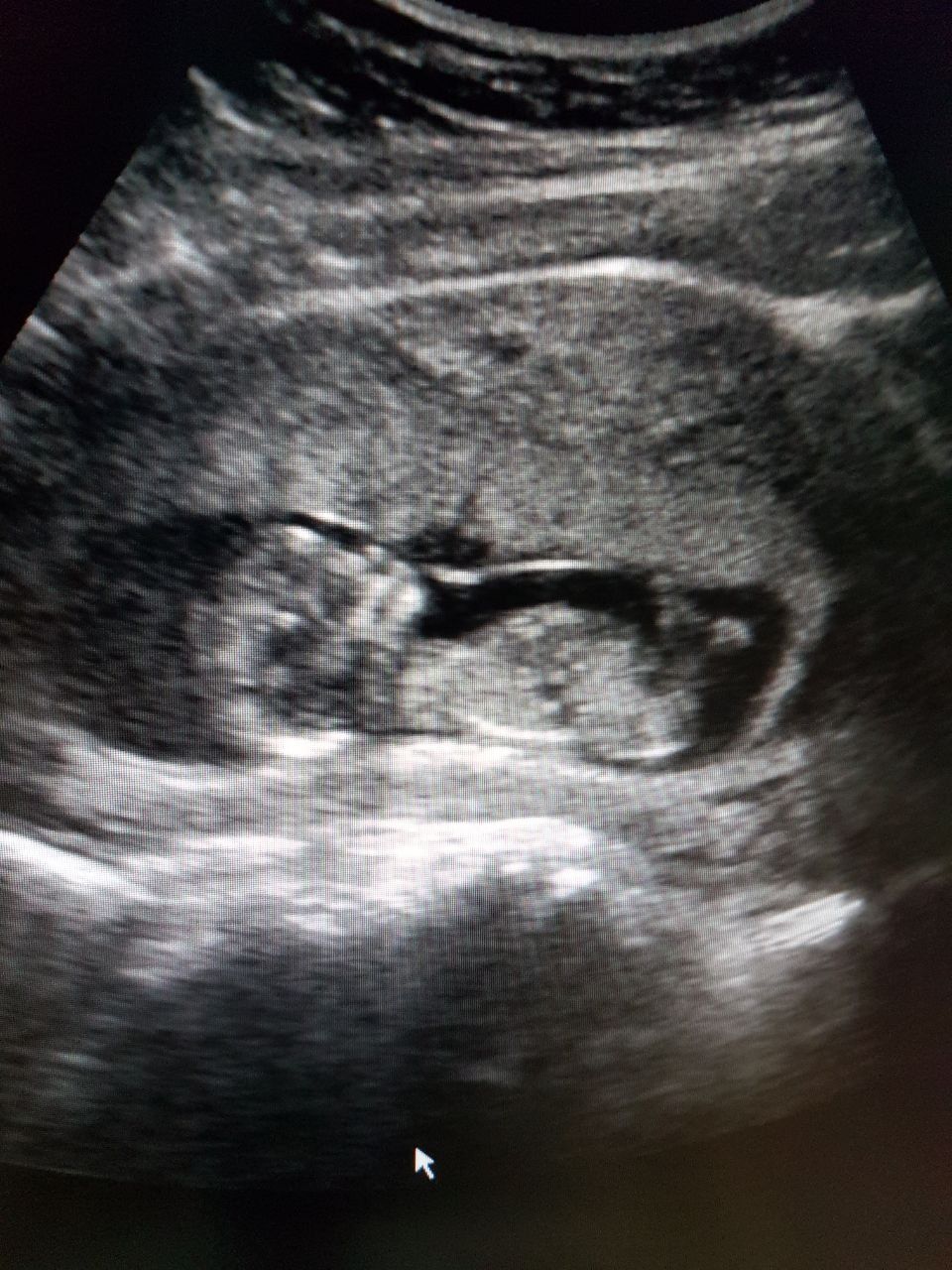 Marisol I. Alvarez Carrasco-49