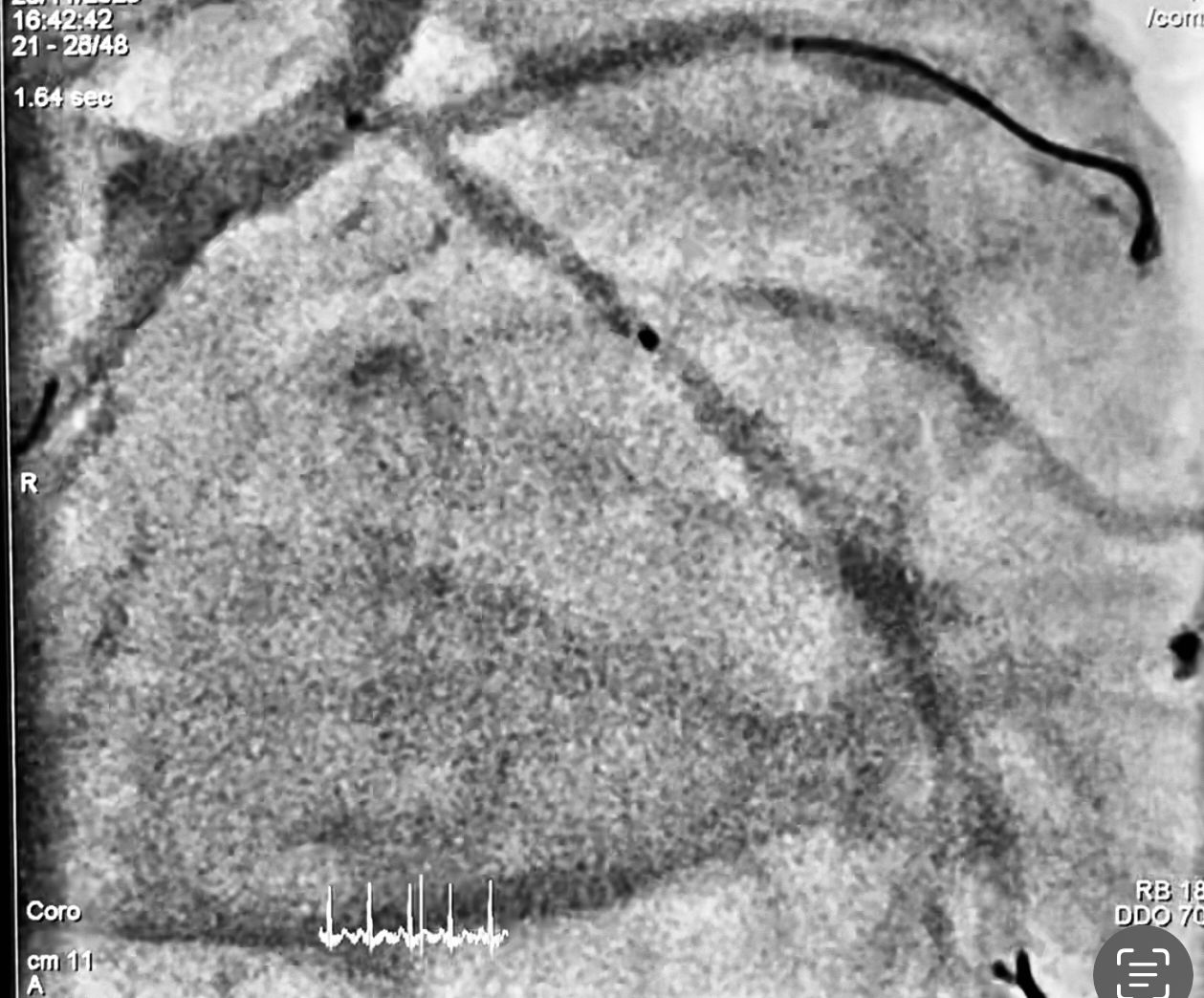 Abdón Ávila Chávez-3