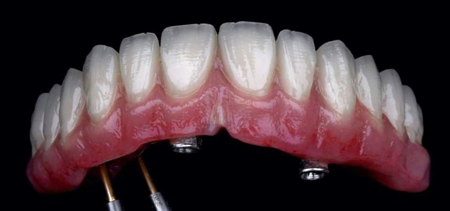 Josué Márquez Gómez-190