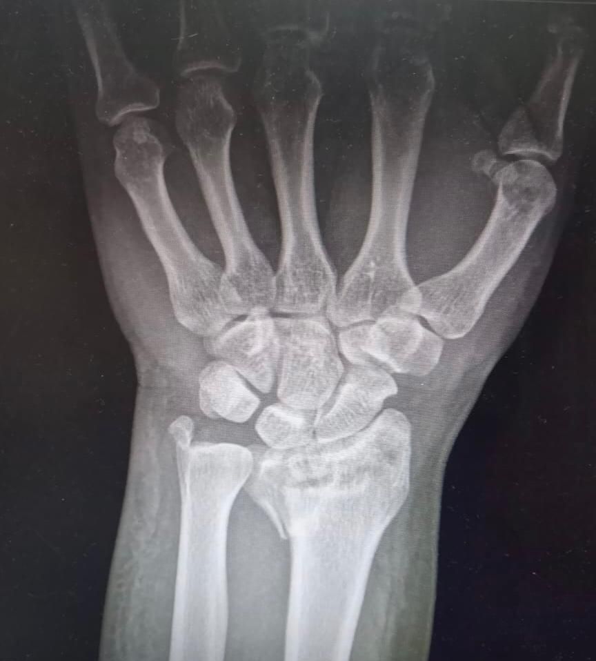 Gabriel Ramírez Lozano-25