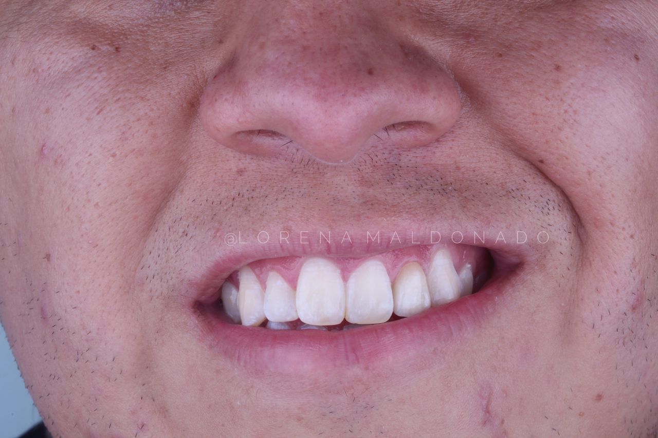 Ana Lorena Maldonado Munguia-10