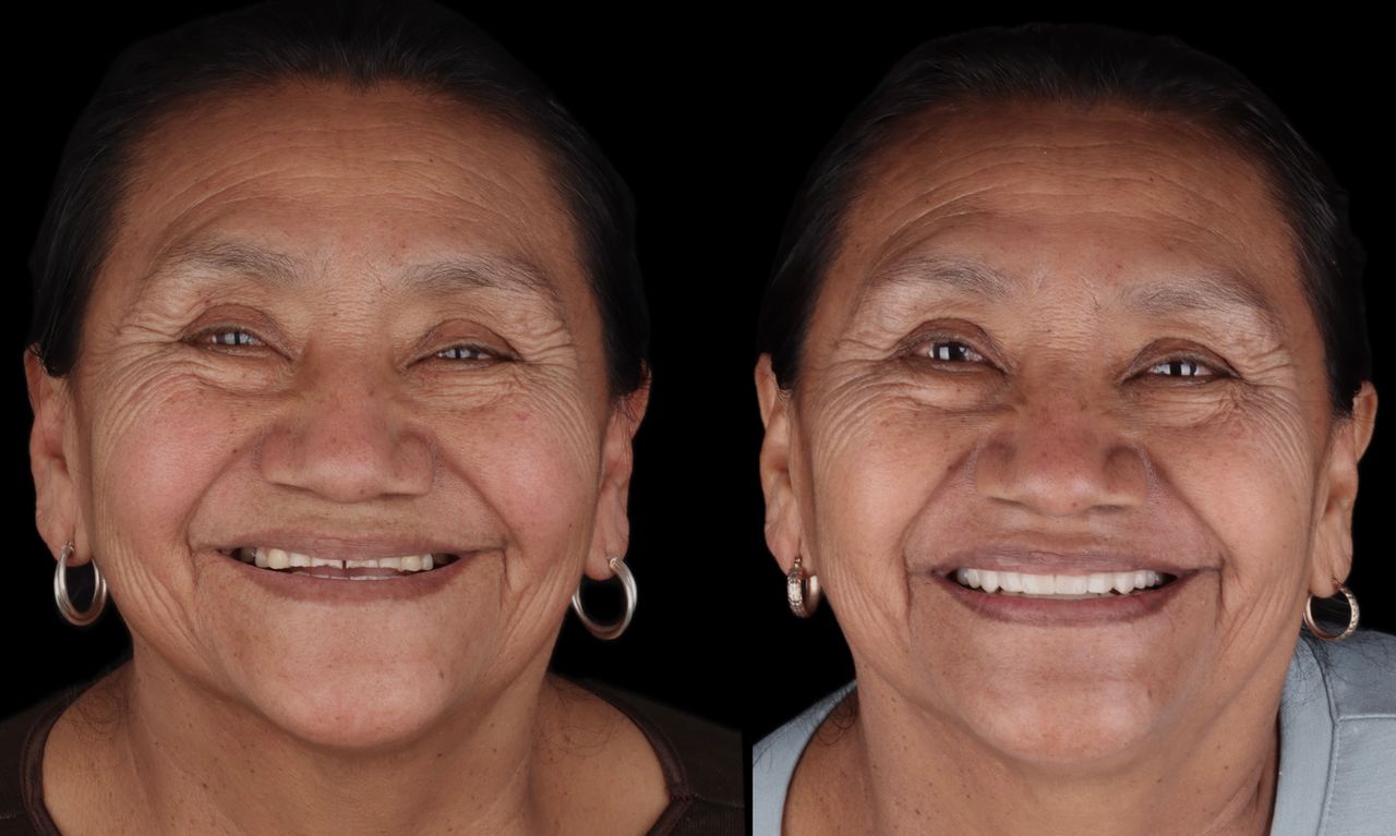 Alexandro Castrellon-6