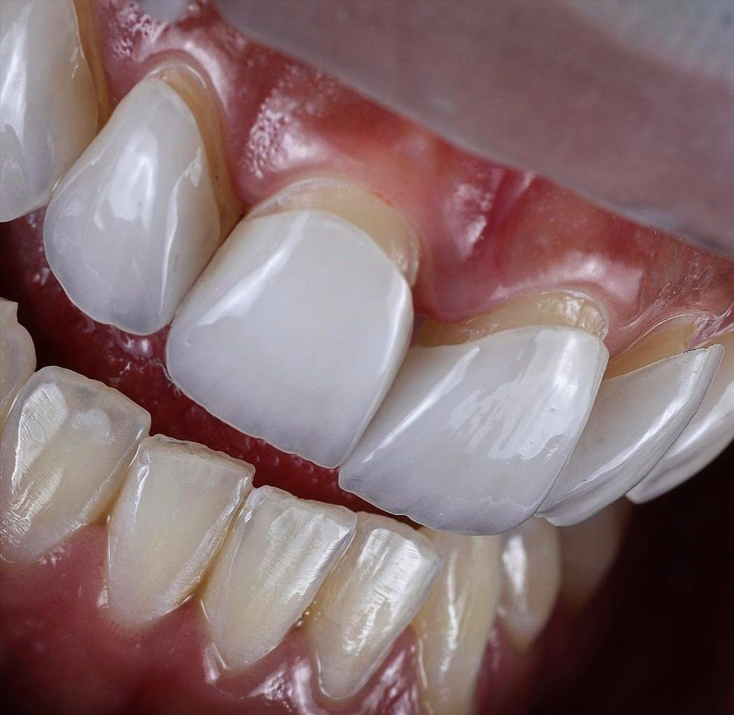 Juan Carlos Hernández Tobón-3