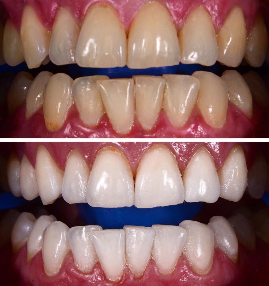 Blanca Elvia Soto Canales-4